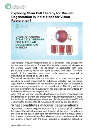 Exploring Stem Cell Therapy for Macular Degeneration in India