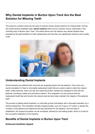 Why Dental Implants in Burton Upon Trent Are the Best Solution for Missing Teeth