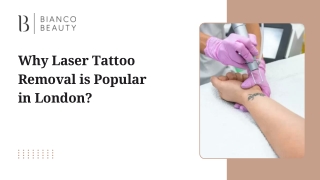 Why Laser Tattoo Removal is Popular in London