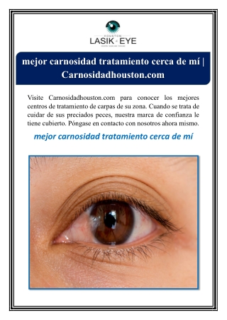 mejor carnosidad tratamiento cerca de mí | Carnosidadhouston.com