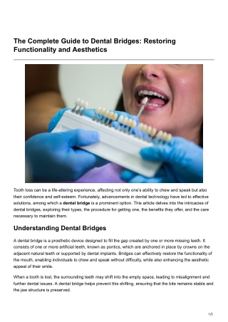 the complete guide to dental bridges restoring