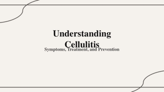 cellulitis symptoms ppt
