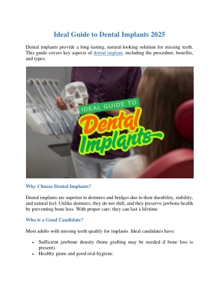 Ideal Guide to Dental Implant 2025