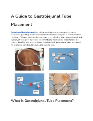 a guide to gastrojejunal tube