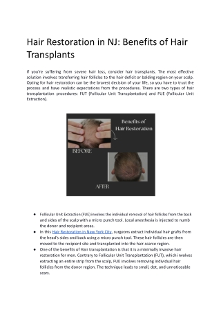Hair Restoration in NJ_ Benefits of Hair Transplants