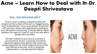 acne learn how to deal with it dr deepti shrivastava