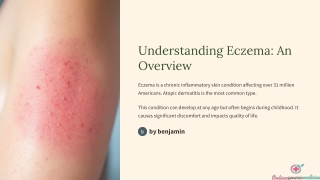 Eczema its causes, symptoms and treatment.