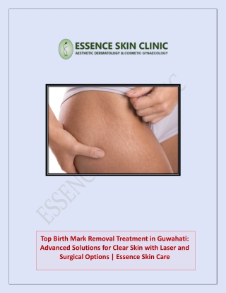 top birth mark removal treatment in guwahati