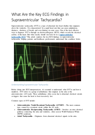 What Are the Key ECG Findings in Supraventricular Tachycardia