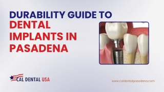 Durability Guide to Dental Implants in Pasadena