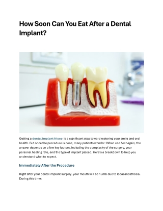 How Soon Can You Eat After a Dental Implant