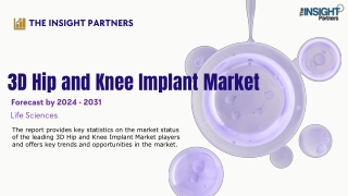 3D Hip and Knee Implant Market