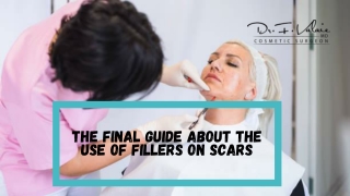 The Final Guide about the Use of Fillers on Scars