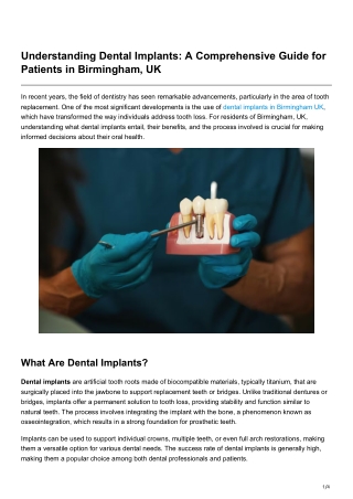 Understanding Dental Implants A Comprehensive Guide for Patients in Birmingham UK