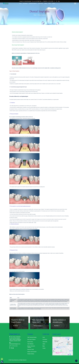 Dental Implants in Kanakapura Road | Konanakunte Cross