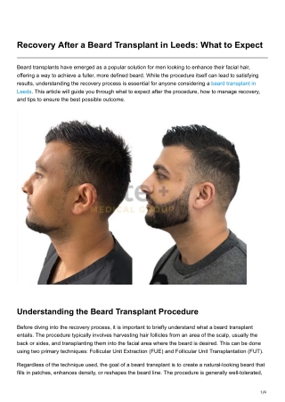 Recovery After a Beard Transplant in Leeds What to Expect