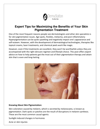 Expert Tips for Maximizing the Benefits of Your Skin Pigmentation Treatment