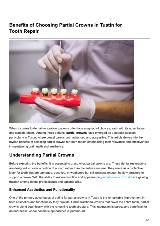 Benefits of Choosing Partial Crowns in Tustin for ToothRepair