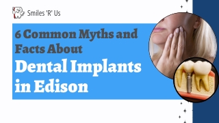 6 Common Myths and Facts About Dental Implants in Edison