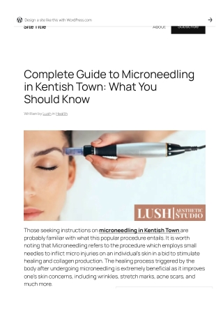 Complete Guide to Microneedling in Kentish Town What You Should Know
