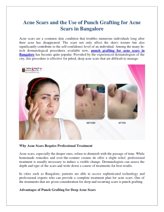 Acne Scars and the Use of Punch Grafting for Acne Scars in Bangalore