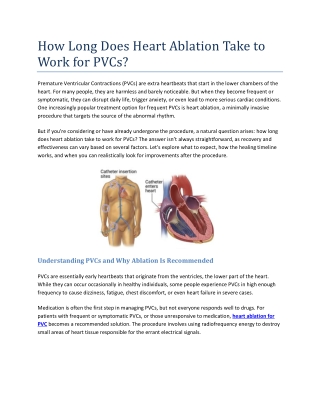 How Long Does Heart Ablation Take to Work for PVCs