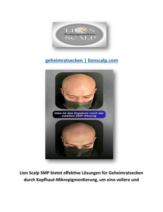 geheimratsecken lionscalp com