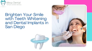 Brighten Your Smile with Teeth Whitening and Dental Implants in San Diego