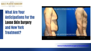 What Are Your Anticipations For the Loose Skin Surgery and New York Treatment?