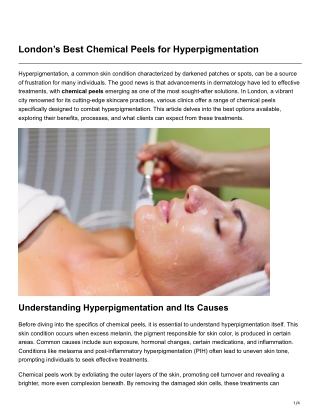 Londons Best Chemical Peels for Hyperpigmentation