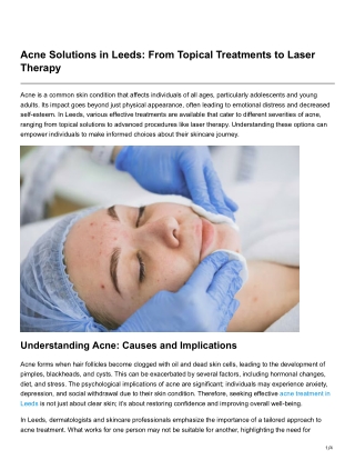 Acne Solutions in Leeds From Topical Treatments to Laser Therapy