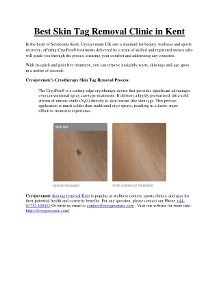Best Skin Tag Removal Clinic in Kent