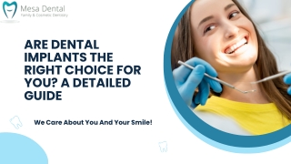 Are Dental Implants the Right Choice for You? A Detailed Guide