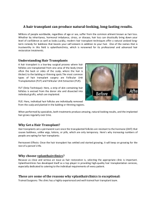 hair transplant results.