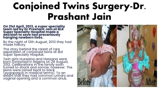 Conjoined Twins Surgery-Dr  Prashant Jain