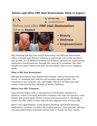 Before and After PRP Hair Restoration: What to Expect
