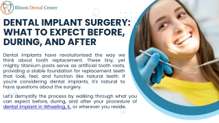 Dental Implant Surgery What to Expect Before, During, and After