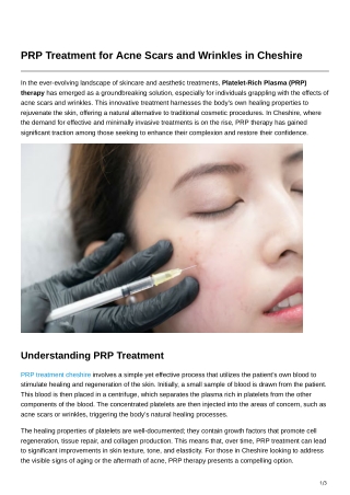 PRP Treatment for Acne Scars and Wrinkles in Cheshire