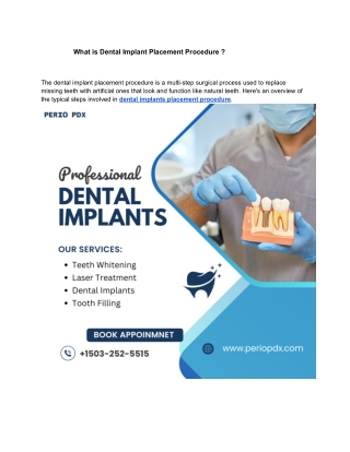 What is Dental Implant Placement Procedure ?