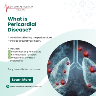 drsiam pdf What is Pericardial Disease