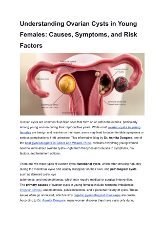 Understanding Ovarian Cysts in Young Females_ Causes, Symptoms, and Risk Factors