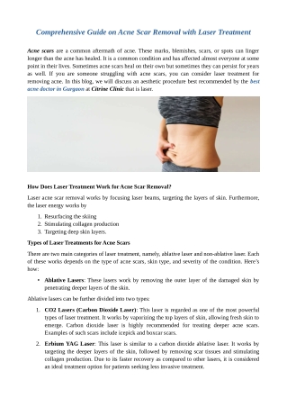 Comprehensive Guide on Acne Scar Removal with Laser Treatment