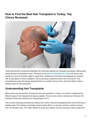 How to Find the Best Hair Transplant in Turkey Top Clinics Reviewed