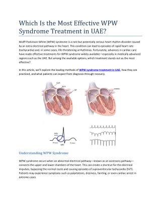 Which Is the Most Effective WPW Syndrome Treatment in UAE