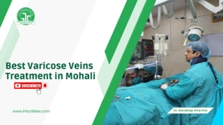 Effective Varicose Veins Treatment for Lasting Relief
