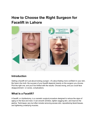 How to Choose the Right Surgeon for Facelift in Lahore
