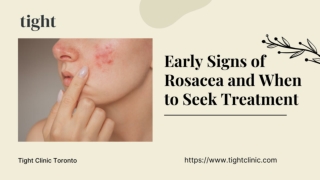 Understanding Rosacea - Early Signs and Treatment Options