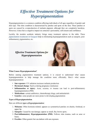 Effective Treatment Options for Hyperpigmentation