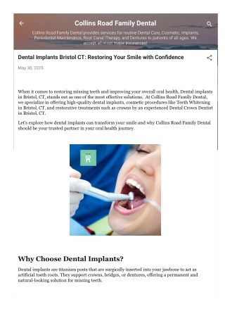 Dental Implants Bristol CT