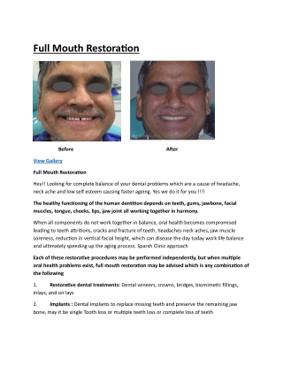 Full Mouth Restoration